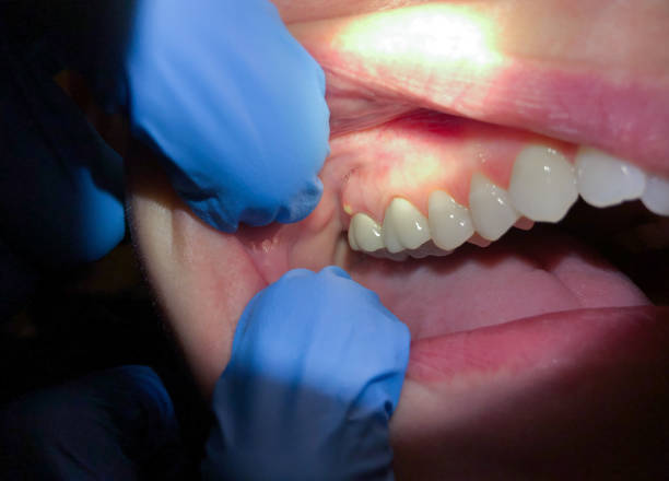 Best Cracked Tooth Emergency Dentist  in Loveland Park, OH