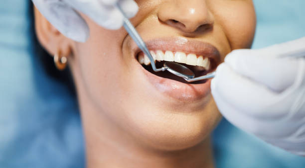 Best Dentist for Tooth Abscess  in Loveland Park, OH