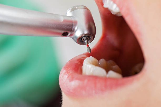 Best Chipped Tooth Repair Near Me  in Loveland Park, OH